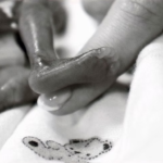 Stillbirth is Still Birth